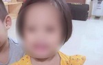 Bé 3 tuổi bị ghim 9 đinh vào đầu tiên lượng nặng
