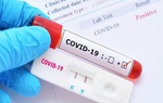 3 sai lầm khi tự thực hiện test nhanh Covid-19 tại nhà