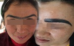 Điêu khắc chân mày: Con dao hai lưỡi có thể làm vẻ đẹp của bạn tan biến