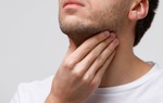 Viêm họng mãn tính có gây ung thư không?