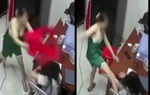 Tạm cách ly người mẹ khỏi con gái vì có hành vi bạo hành trẻ em