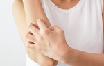 Dị ứng thời tiết có thể ảnh hưởng đến bạn như thế nào?