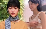 Người mẫu lưỡng tính kể chuyện đi nâng ngực