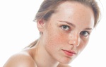 Da nổi đốm nâu không ngứa: Nguyên nhân và cách điều trị