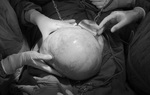 Người phụ nữ 66 tuổi có khối u nặng như trẻ 3 tháng tuổi