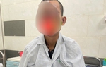 Bệnh nhân bị cháy sém, nguy cơ mù khi vừa dùng điện thoại vừa sạc