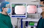 Ung thư đường tiêu hóa: Trì hoãn kiểm tra, hậu quả khó lường