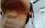 Công an điều tra vụ bố dượng bị tố bạo hành con riêng của vợ 