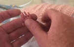 Bé sinh non nặng vỏn vẹn 5 lạng, hình ảnh sau 1 năm gây bất ngờ