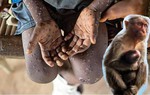 Đậu mùa khỉ khiến 66 người tử vong, chưa có vaccine, cần làm gì nếu nghi ngờ nhiễm bệnh?