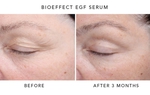 Ứng dụng công nghệ Peptide trong chăm sóc da