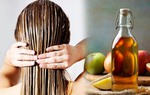 4 công thức mặt nạ tóc giúp trị gàu hiệu quả