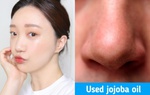 7 cách khiến lỗ chân lông từ to hóa nhỏ, da dẻ mướt căng và bóng mịn thấy rõ