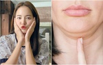 4 thói quen khiến cằm nọng, da chảy xệ mà chị em cứ vô tư làm hàng ngày