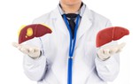 Nghiên cứu mới: Bổ sung vitamin B, folate giúp hỗ trợ điều trị gan nhiễm mỡ không do rượu