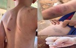 Kịp thời phát hiện nguy cơ bị bạo hành đối với trẻ em có cha mẹ ly hôn