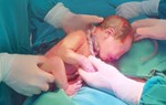 Cứu thành công sản phụ U40 mắc rau tiền đạo trung tâm, băng huyết nguy kịch