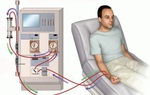 Người chạy thận nhân tạo sống được bao lâu?