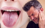 Người đàn ông bị nhiệt miệng, đi khám bàng hoàng khi biết đã ung thư giai đoạn 4