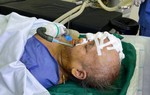 Giải phóng khối u "quái" trên mặt cụ bà 73 tuổi