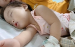 Bé sốt cao mấy ngày không khỏi, mẹ bàng hoàng khi biết con nhiễm virus Adeno
