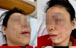Tạm giữ người đàn ông "bắt cóc" đánh đập vợ cũ gần 1 ngày