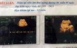 Tạm giữ bảo vệ trường mầm non nghi xâm hại học sinh lớp 6 dẫn đến mang thai