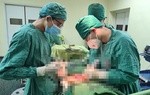 Người phụ nữ đau bụng tưởng rối loạn tiêu hóa, khi kiểm tra nhận kết quả ung thư