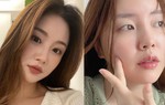 6 cách ngăn ngừa mụn trong dịp Tết