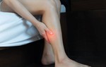 Người phụ nữ mất 2 chân vì cục máu đông: Cảnh giác với những dấu hiệu đầu tiên của bệnh