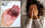 Chuyên gia cảnh báo thói quen làm tăng nguy cơ rụng tóc, khiến vi khuẩn phát triển