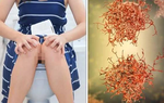 1 dấu hiệu trong kỳ kinh nguyệt cảnh báo bệnh ung thư 