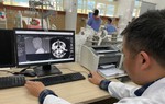 Người suy thận, kẻ bị nhồi máu não sau cuộc rượu  