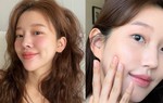 4 bước chăm da giúp xóa mờ và ngăn chặn đốm nâu hiệu quả