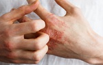 2 bộ phận trên cơ thể bị ngứa là dấu hiệu mắc bệnh tiểu đường