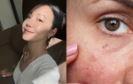 Kem chống nắng: Dùng đúng cách để chống già