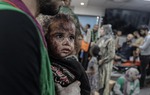 Những bức hình ám ảnh tại bệnh viện Gaza bị tấn công: Ánh mắt hoảng sợ tột cùng của những đứa trẻ vô tội