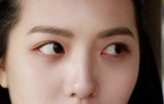 Nữ sinh viên bị đột quỵ mắt, da nhăn nheo vì 1 thói quen nhiều người trẻ hay làm