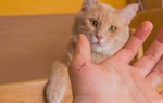 Người đàn ông 35 tuổi hôn mê, phải thở máy do bị mèo cắn