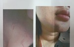 TPHCM: Xác minh thông tin nữ sinh lớp 12 kêu cứu vì bị phụ huynh của bạn đánh hội đồng 