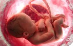 Dây rốn quấn 2 vòng quanh cổ thai nhi, 1 thói quen khi mang thai của người mẹ là "thủ phạm"
