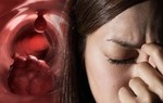 15 dấu hiệu "siêu nhỏ" cảnh báo ung thư mà rất nhiều người bỏ qua