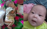 Hơn 230.000 trẻ suy dinh dưỡng cấp tính nặng nhưng chỉ gần 1% được điều trị
