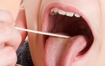 Điểm danh 7 biến chứng viêm VA thường gặp