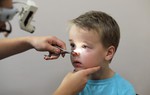 4 cách chẩn đoán viêm VA và phương pháp phòng ngừa
