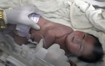 Bé gái Syria chào đời trong đống đổ nát của tòa nhà bị sập, dây rốn vẫn nối với bánh nhau trong bụng mẹ