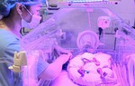 3 tháng diệu kỳ với bé gái sinh non ở tuần 24, nặng vỏn vẹn 700g