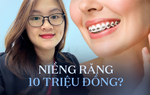 Cơn sốt "Niềng răng từ A đến Z giá rẻ dưới 10 triệu đồng", bác sĩ cảnh báo 