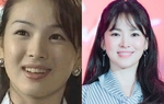 Song Hye Kyo, Lâm Tâm Như thăng hạng nhan sắc nhờ niềng răng