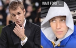 Tình trạng liệt nửa mặt của Justin Bieber hiện ra sao?